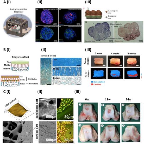 Fabricating the cartilage: recent achievements